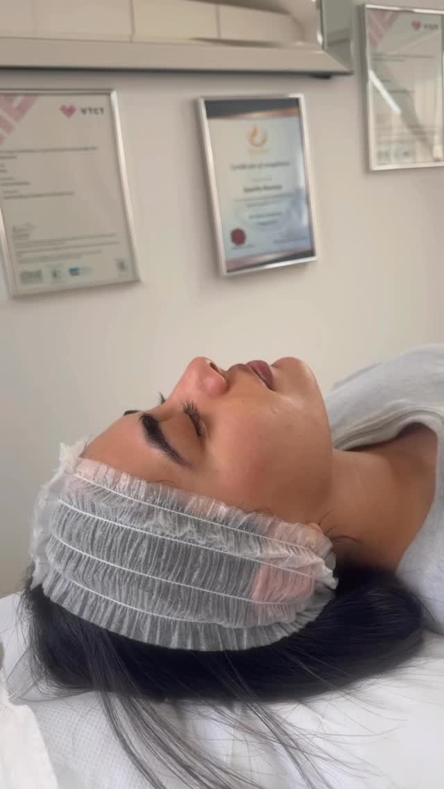 Million dollar facial for the beautiful @heirbeauty , the most amazing facial for all skin types
#microneedlingtherapy #mocroneedling #facials #prp #prpface #skin #fypage #followforfollowback #harrow #explorepage✨